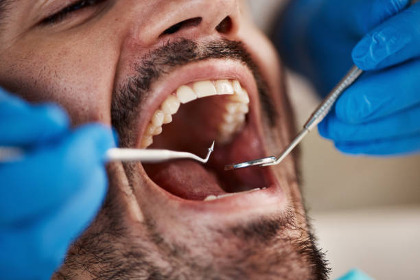 Best Dentist for Tooth Abscess  in Taunton, MA